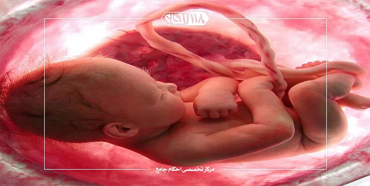 سقط جنین